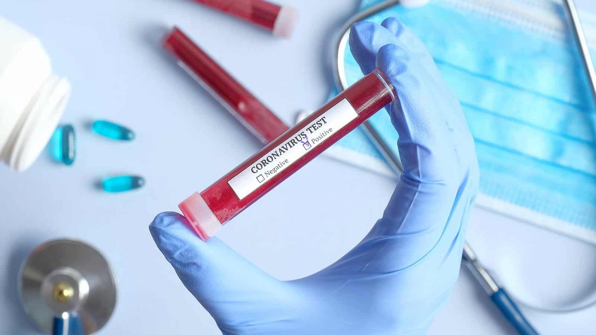 Cordeirópolis investe em testes rápidos para detectar coronavírus